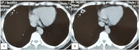 Fig 3 –