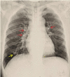 Fig 1 –