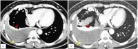 Fig 5 –