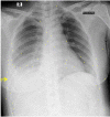 Fig 4 –