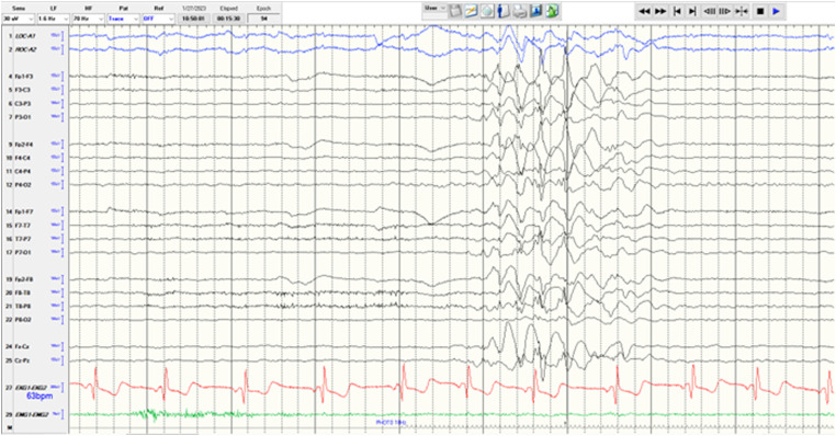 Figure 1.