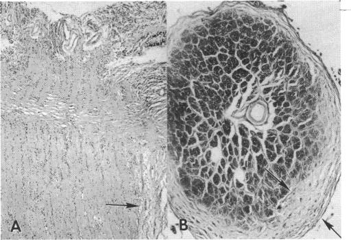 FIGURE 31