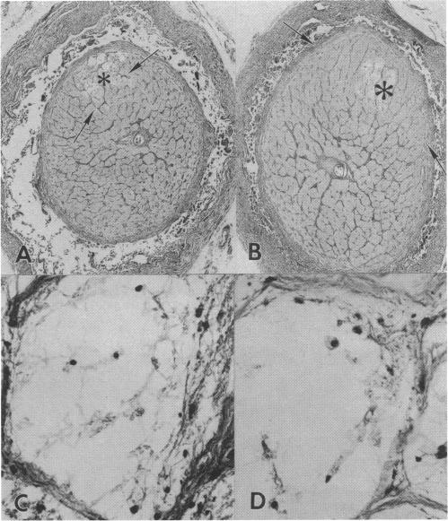 FIGURE 28