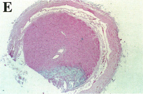 FIGURE 25 E