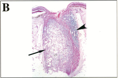 FIGURE 25 B