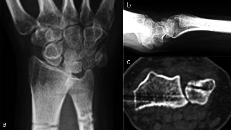 Figure 11