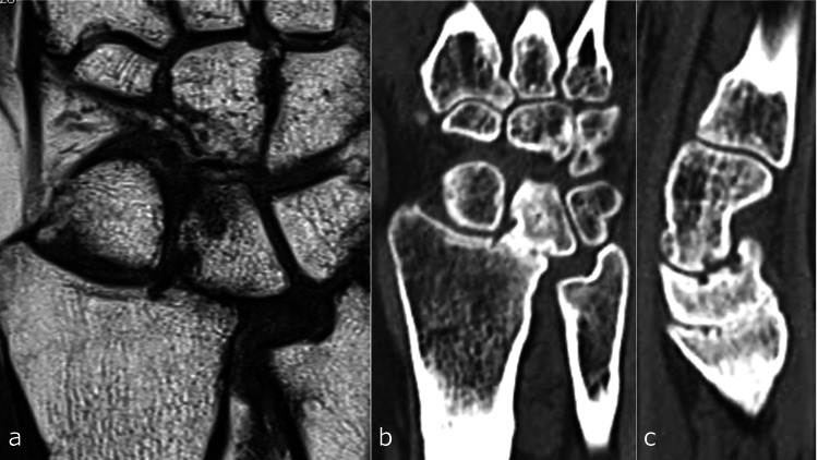 Figure 12