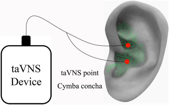 FIGURE 1