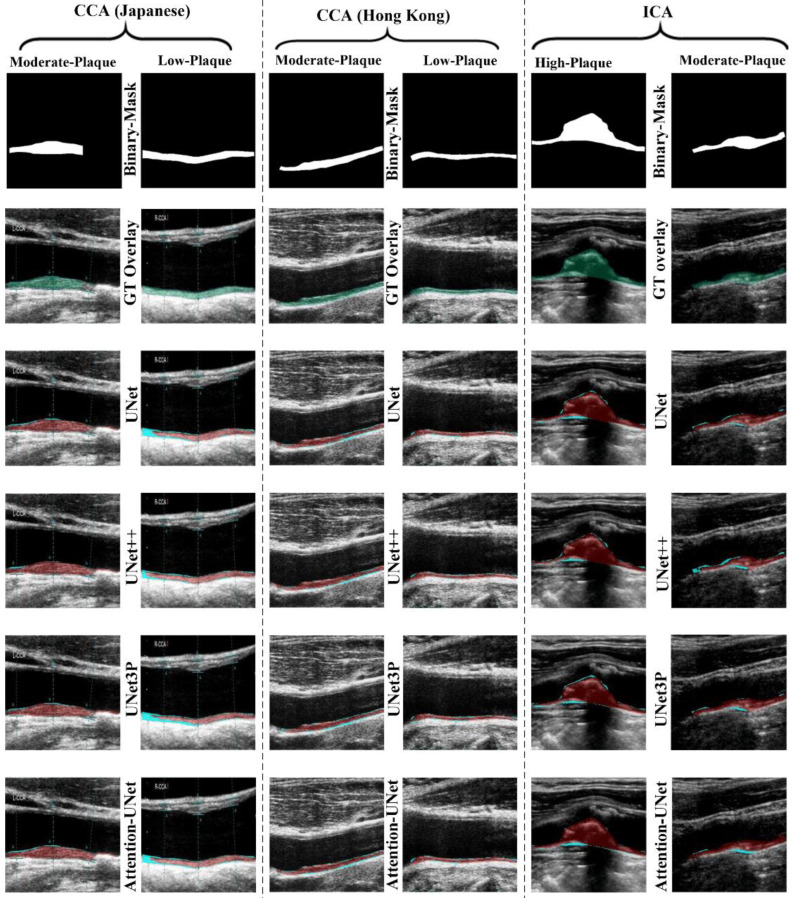 Figure 11