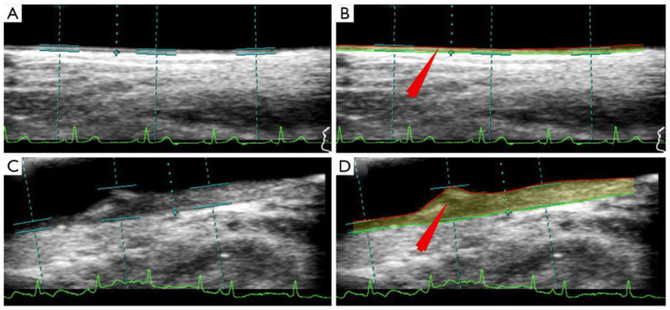 Figure 6