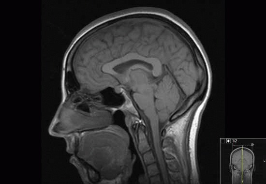 Fig 3a