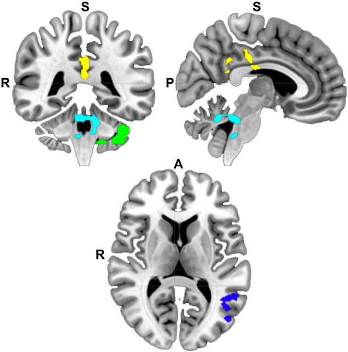 Fig. 2.