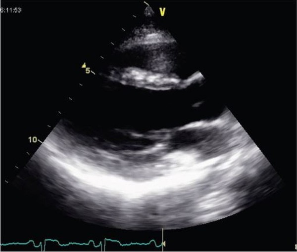 Figure 2