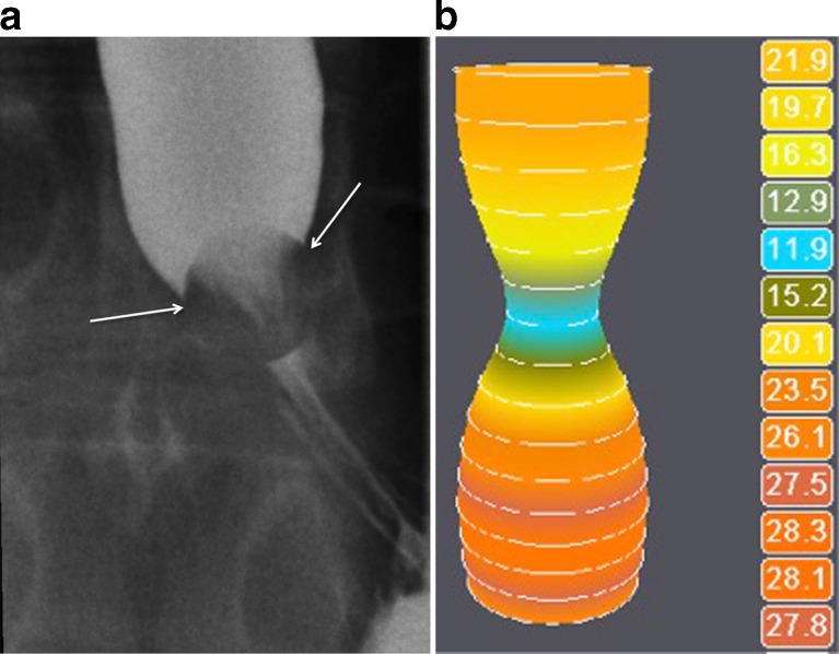 Fig. 2