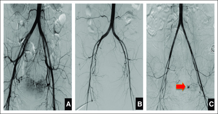 FIG 2