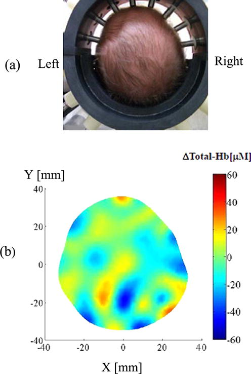 Figure 16