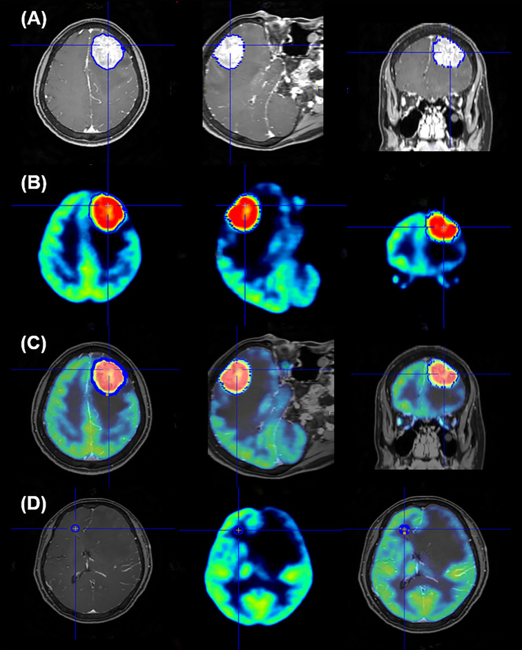 Figure 1