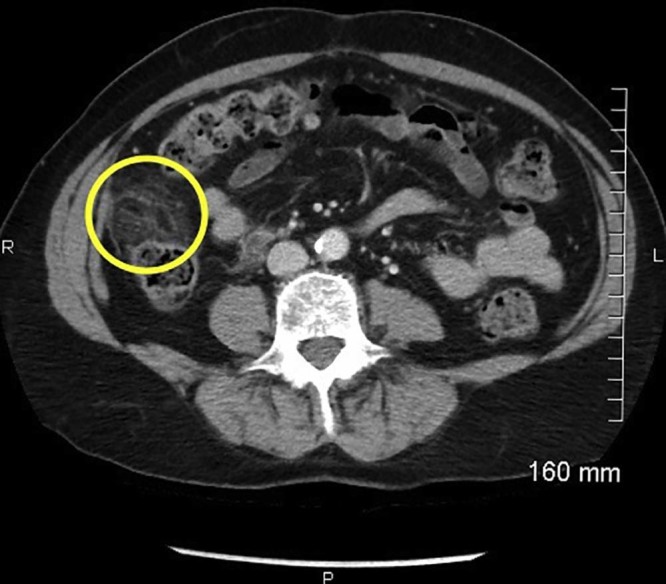 Fig. 2