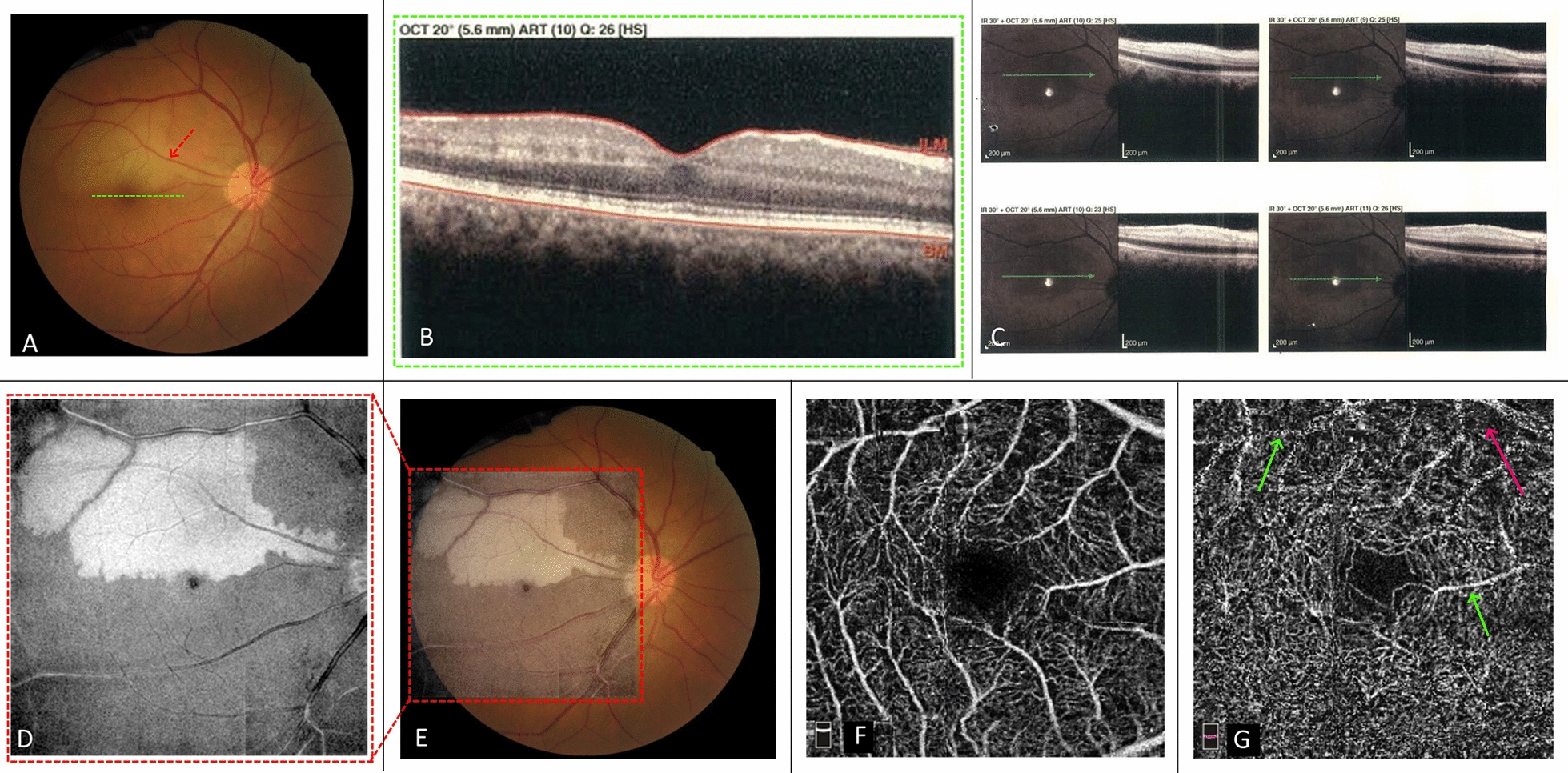 Fig. 1