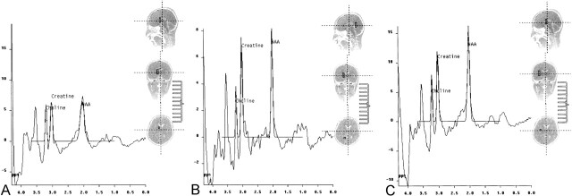 Fig 2.