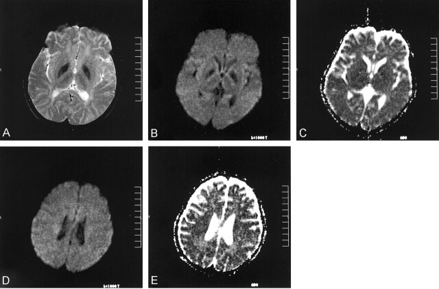 Fig 3.