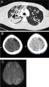 Fig. 1
