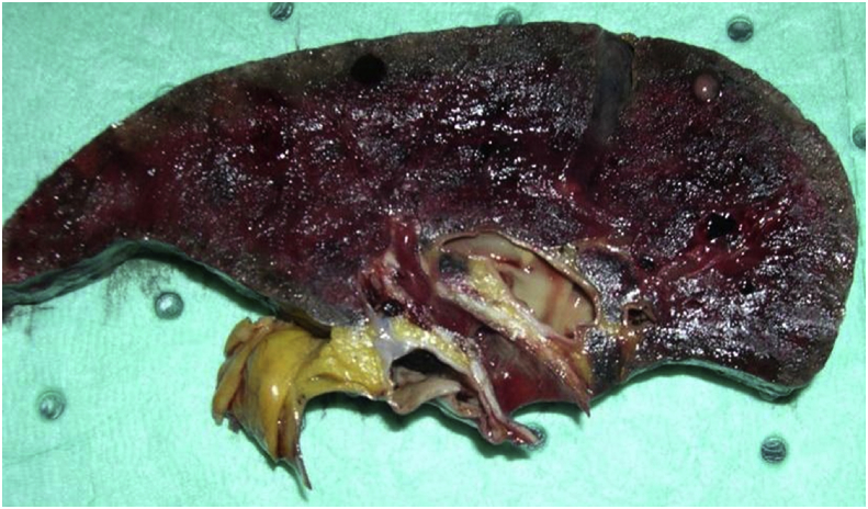 Fig. 2