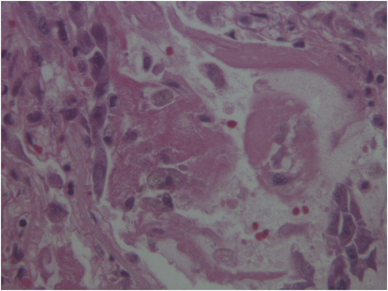 Fig. 4