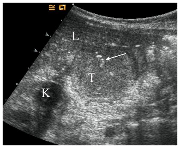 Figure2