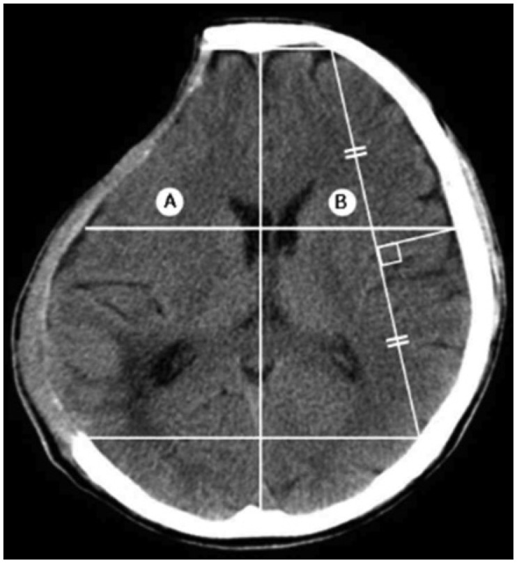 FIGURE 1