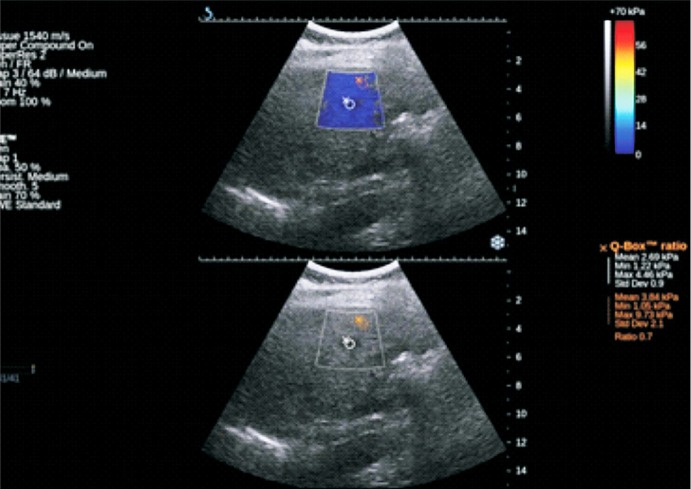 Fig. 2