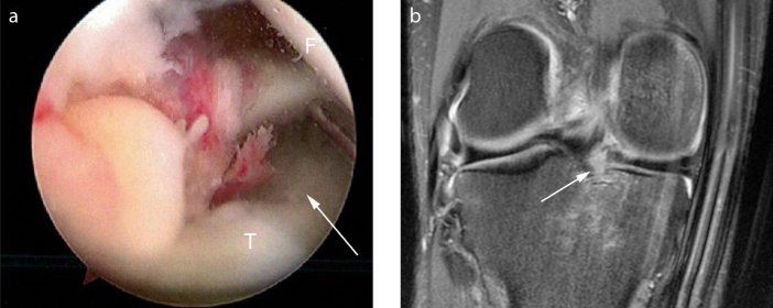 Figure 1. a, b