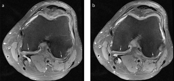 Figure 4. a, b