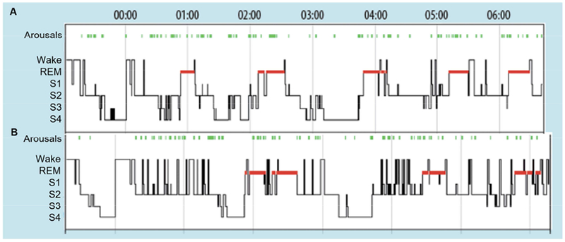 Figure 1: