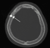 Fig 2.
