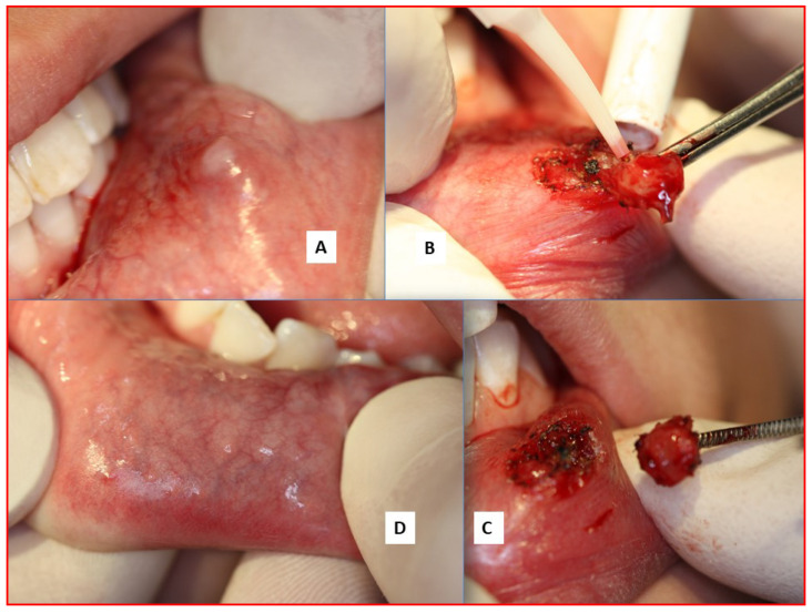 Figure 7