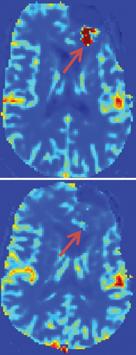 Figure 3b: