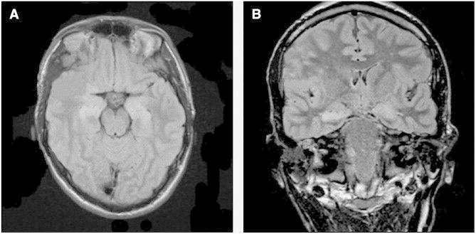 Fig. 1