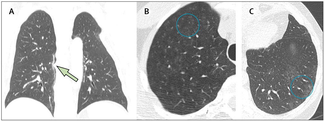 Figure 2: