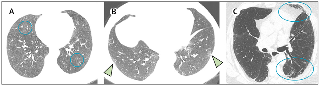 Figure 1: