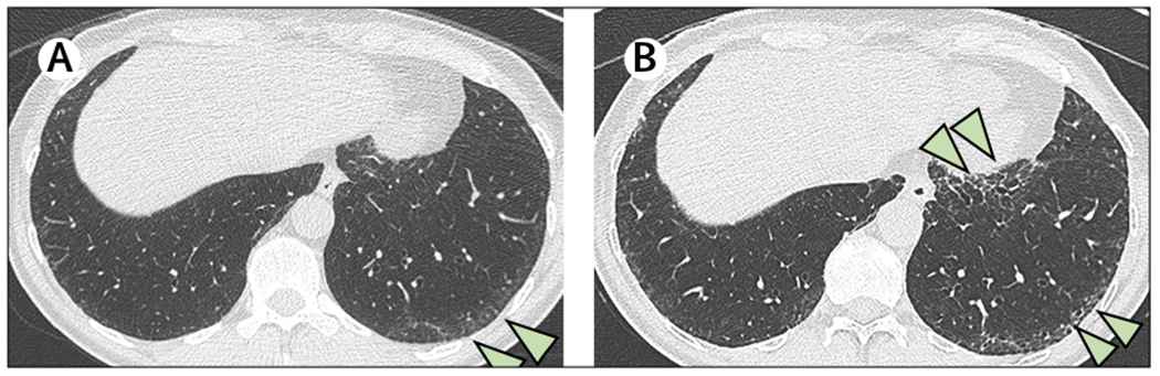 Figure 3: