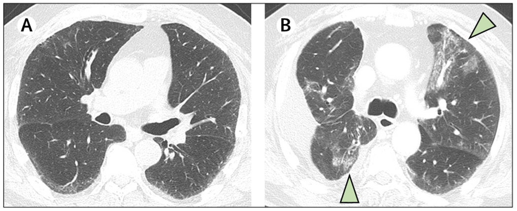 Figure 4: