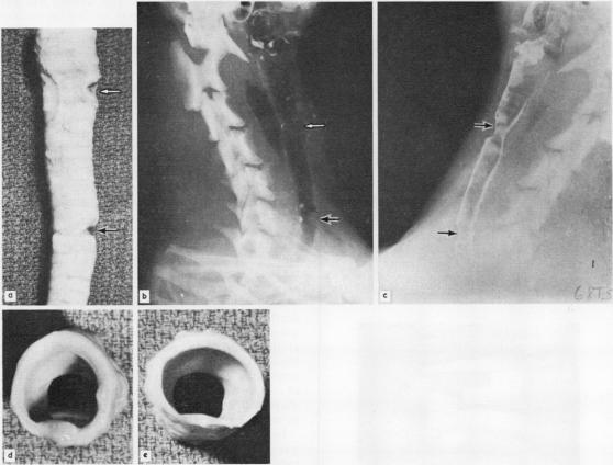 graphic file with name thorax00126-0043-a.jpg