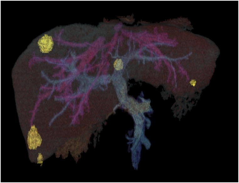 graphic file with name pnas.1818892115fig01.jpg