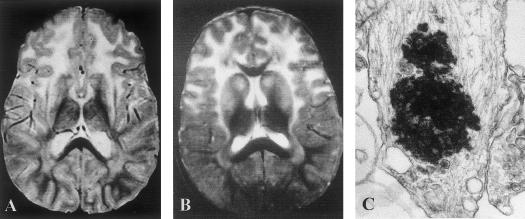 Figure  1