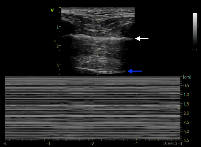 Fig. 2