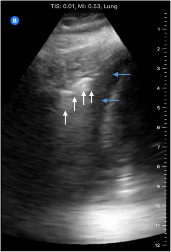 Fig. 4