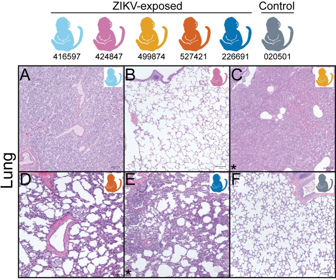 Fig 13