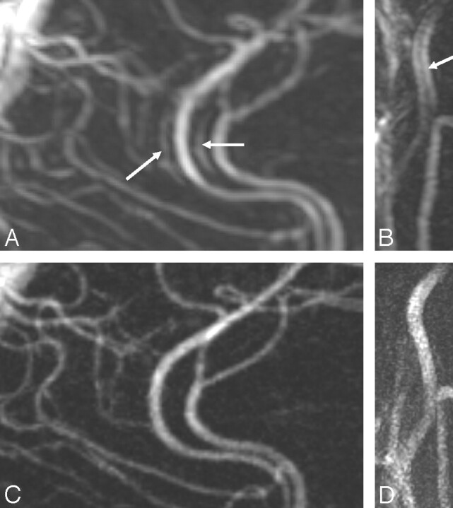 Fig 2.