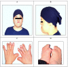 Fig. 1